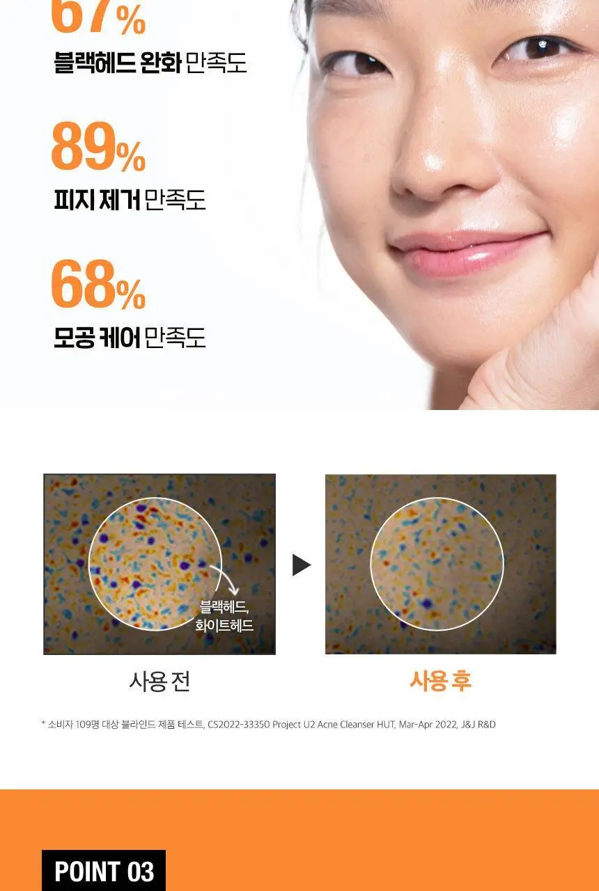 [매끈클린모공폼/트러블예방] 뉴트로지나 딥클린 아크네 포밍 클렌저 150g 기획(+100g) 상세페이지 11